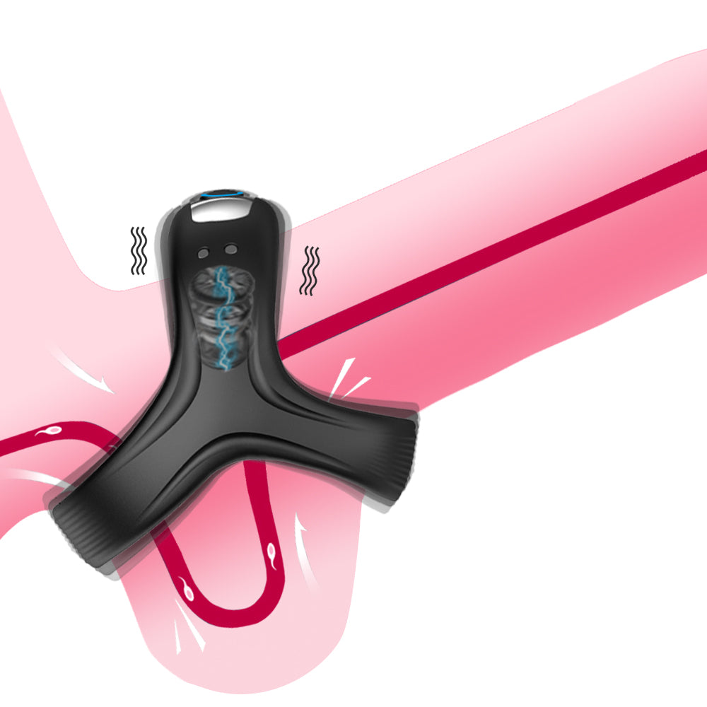 Kink Ring